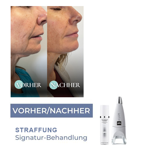 Straffung Signature Gesichtsbehandlung
